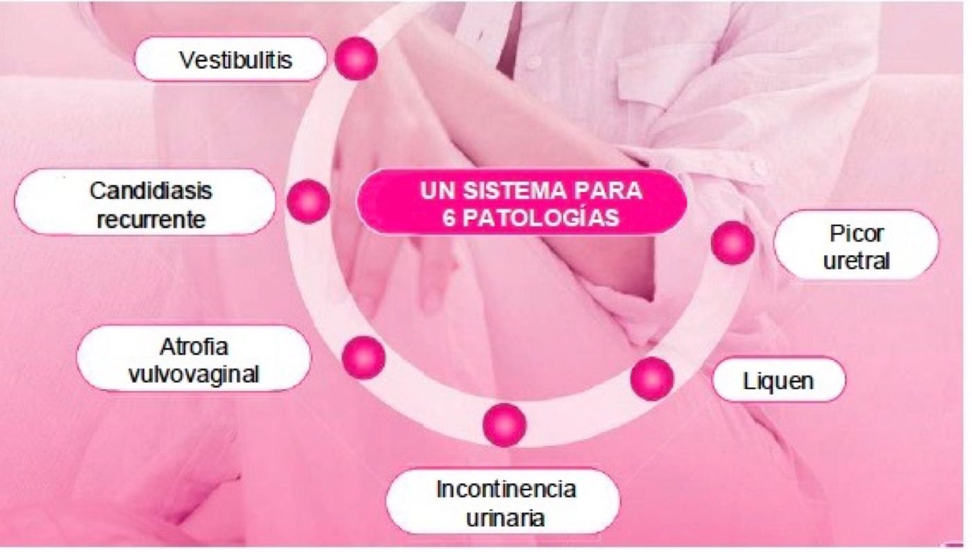 Protocolo Caress Flow: aplicación tópica y vaginal